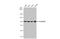 Phospholipase A2 Group IVA antibody, GTX110218, GeneTex, Western Blot image 