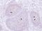 Presenilin 1 antibody, GTX116016, GeneTex, Immunohistochemistry paraffin image 