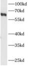 Rho Guanine Nucleotide Exchange Factor 5 antibody, FNab00563, FineTest, Western Blot image 