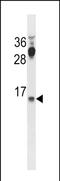 Cysteine And Tyrosine Rich 1 antibody, PA5-72153, Invitrogen Antibodies, Western Blot image 