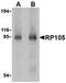 CD180 Molecule antibody, orb74728, Biorbyt, Western Blot image 