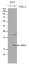 Immunoglobulin Lambda Like Polypeptide 1 antibody, GTX113366, GeneTex, Western Blot image 