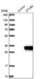 OTU Deubiquitinase, Ubiquitin Aldehyde Binding 2 antibody, NBP1-88410, Novus Biologicals, Western Blot image 