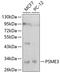 Proteasome activator complex subunit 3 antibody, GTX32822, GeneTex, Western Blot image 