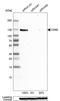 CD68 Molecule antibody, HPA048982, Atlas Antibodies, Western Blot image 