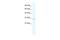 Chloride Intracellular Channel 2 antibody, A08639, Boster Biological Technology, Western Blot image 