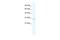 Chloride Intracellular Channel 2 antibody, A08639, Boster Biological Technology, Western Blot image 