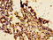 Interleukin 18 Receptor 1 antibody, CSB-PA623807LA01HU, Cusabio, Immunohistochemistry frozen image 