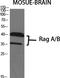 Ras Related GTP Binding A antibody, STJ95355, St John