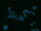 Early Endosome Antigen 1 antibody, 22266-1-AP, Proteintech Group, Immunofluorescence image 