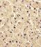 Phosphoglucomutase 1 antibody, 61-146, ProSci, Immunohistochemistry paraffin image 