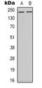 BRCA1 DNA Repair Associated antibody, orb338847, Biorbyt, Western Blot image 