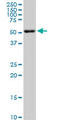 AKT Serine/Threonine Kinase 2 antibody, LS-C133859, Lifespan Biosciences, Western Blot image 