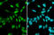 Androgen Receptor antibody, GTX100056, GeneTex, Immunocytochemistry image 