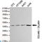 SET And MYND Domain Containing 2 antibody, LS-C813032, Lifespan Biosciences, Western Blot image 