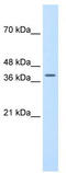 Transcription Factor B2, Mitochondrial antibody, TA335483, Origene, Western Blot image 