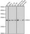 RAB2A, Member RAS Oncogene Family antibody, A06007, Boster Biological Technology, Western Blot image 