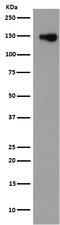 Collagen Type VI Alpha 1 Chain antibody, M02226, Boster Biological Technology, Western Blot image 