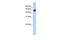 Regulator Of Microtubule Dynamics 3 antibody, GTX46304, GeneTex, Western Blot image 