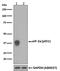 Eukaryotic Translation Initiation Factor 2 Subunit Alpha antibody, P04387, Boster Biological Technology, Western Blot image 