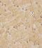 Thymidine Kinase 1 antibody, M04850-1, Boster Biological Technology, Immunohistochemistry paraffin image 