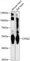 Calsequestrin 2 antibody, 16-753, ProSci, Western Blot image 