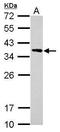 Calponin 2 antibody, GTX119368, GeneTex, Western Blot image 