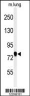 Semaphorin 3C antibody, 61-781, ProSci, Western Blot image 