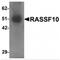 Ras association domain-containing protein 10 antibody, MBS151531, MyBioSource, Western Blot image 