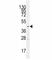 Solute Carrier Family 16 Member 1 antibody, F48179-0.4ML, NSJ Bioreagents, Western Blot image 