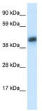 Asialoglycoprotein Receptor 1 antibody, TA334279, Origene, Western Blot image 