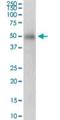 5 -AMP-activated protein kinase subunit gamma-2 antibody, H00051422-D01P, Novus Biologicals, Western Blot image 