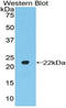 POTE Ankyrin Domain Family Member G antibody, LS-C297393, Lifespan Biosciences, Western Blot image 