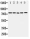 ATP Binding Cassette Subfamily G Member 1 antibody, PA1868, Boster Biological Technology, Western Blot image 