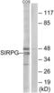 Signal Regulatory Protein Gamma antibody, LS-C120396, Lifespan Biosciences, Western Blot image 