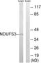 NADH:Ubiquinone Oxidoreductase Core Subunit S3 antibody, LS-C120123, Lifespan Biosciences, Western Blot image 