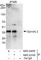 Sprouty RTK Signaling Antagonist 2 antibody, NBP2-04099, Novus Biologicals, Immunoprecipitation image 