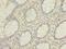 Heterogeneous Nuclear Ribonucleoprotein L antibody, LS-C375900, Lifespan Biosciences, Immunohistochemistry frozen image 
