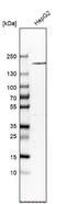 Alpha-2-Macroglobulin antibody, NBP1-85491, Novus Biologicals, Western Blot image 