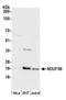 NADH:Ubiquinone Oxidoreductase Core Subunit S8 antibody, A305-437A, Bethyl Labs, Western Blot image 