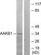 Protein Kinase AMP-Activated Non-Catalytic Subunit Beta 1 antibody, TA326137, Origene, Western Blot image 