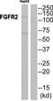 Fibroblast Growth Factor Receptor 2 antibody, TA326230, Origene, Western Blot image 