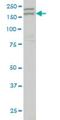 Apoptosis Associated Tyrosine Kinase antibody, H00009625-M04, Novus Biologicals, Western Blot image 