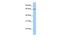 Dynein Cytoplasmic 1 Intermediate Chain 1 antibody, GTX45810, GeneTex, Western Blot image 