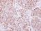 Elongator Acetyltransferase Complex Subunit 4 antibody, NBP2-16322, Novus Biologicals, Immunohistochemistry frozen image 