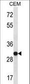 Small Nuclear Ribonucleoprotein Polypeptide A antibody, LS-C161351, Lifespan Biosciences, Western Blot image 