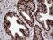 L3MBTL Histone Methyl-Lysine Binding Protein 3 antibody, LS-C795103, Lifespan Biosciences, Immunohistochemistry paraffin image 