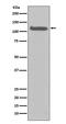 Fibroblast Growth Factor Receptor 3 antibody, M00200-1, Boster Biological Technology, Western Blot image 