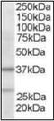 Actin Related Protein 2/3 Complex Subunit 1B antibody, orb88426, Biorbyt, Western Blot image 
