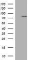 Tumor Protein P73 antibody, LS-C338110, Lifespan Biosciences, Western Blot image 